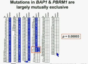 BRUG 4Mutation in BAP1 ^ PBMR1 mut exclu